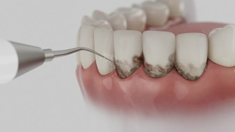 Reliable Dental contractor in Fobes Hill, WA by Dentist Open Now